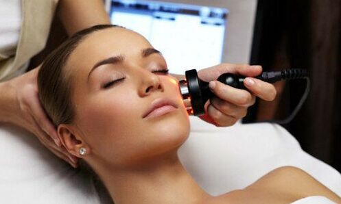 Laser facial rejuvenation